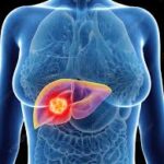 The Hidden Link between Liver Health and Hormone Health